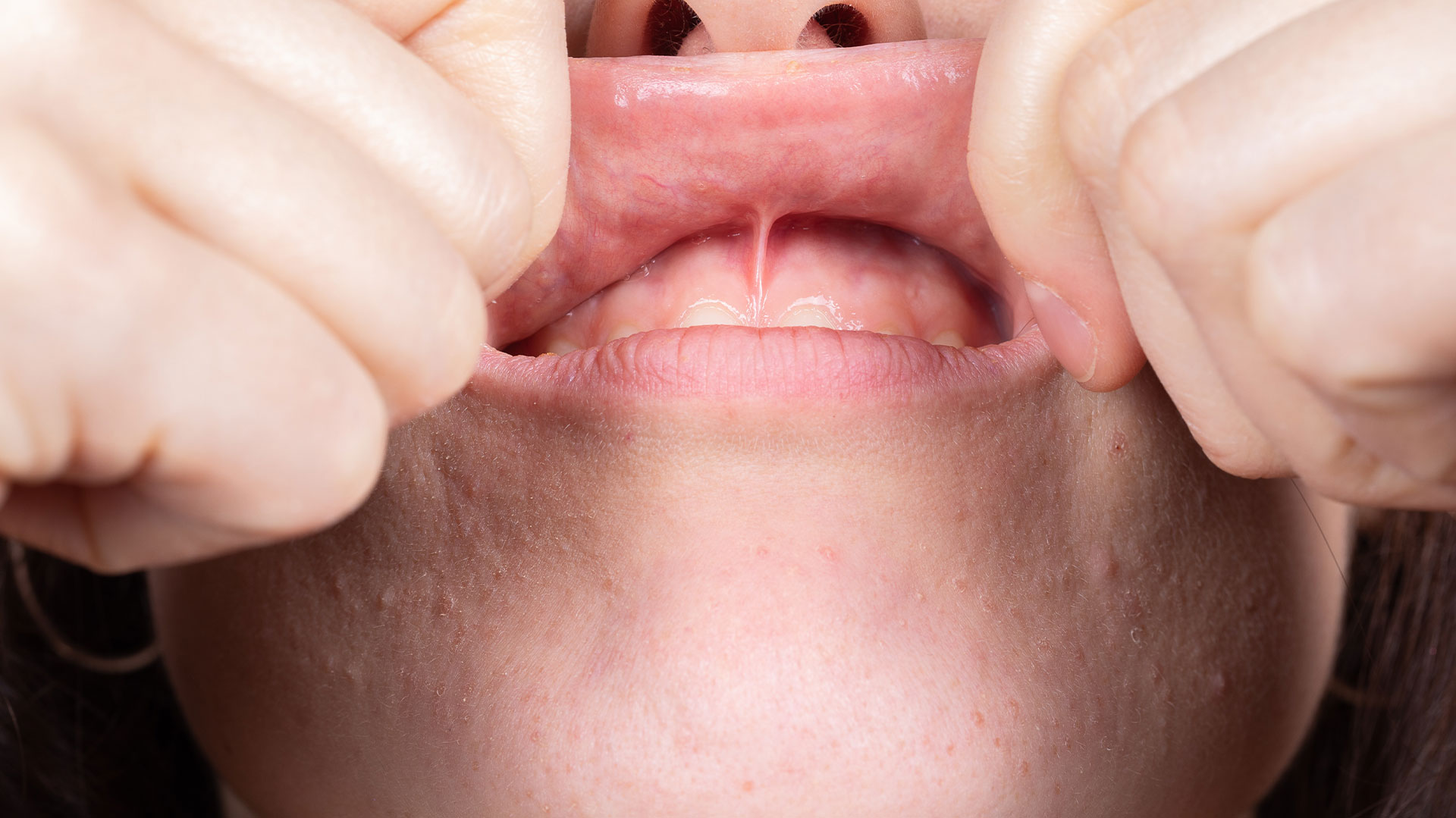 Image shows a close-up view of a person s face with an exaggeratedly large nose, likely due to digital manipulation or a filter effect.